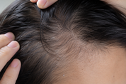 Signature Overnight Scalp Oil